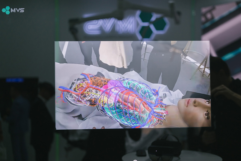 A 3D hologram in the Medgital surgical navigation system integrated into the MVS Smart Operating Room.